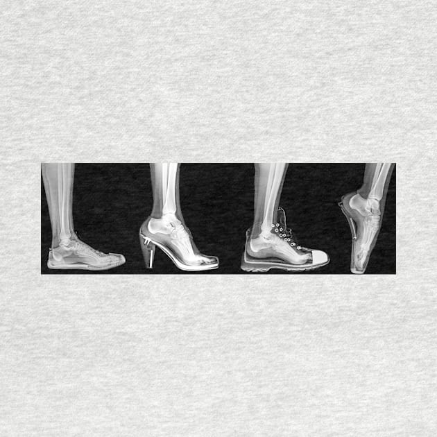 different shoes x-ray (C022/5271) by SciencePhoto
